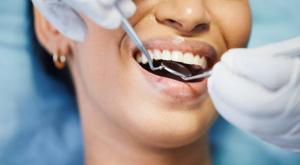 Best Emergency Tooth Extraction in White Knoll, SC