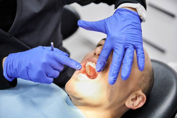 Best Emergency Tooth Extraction in White Knoll, SC