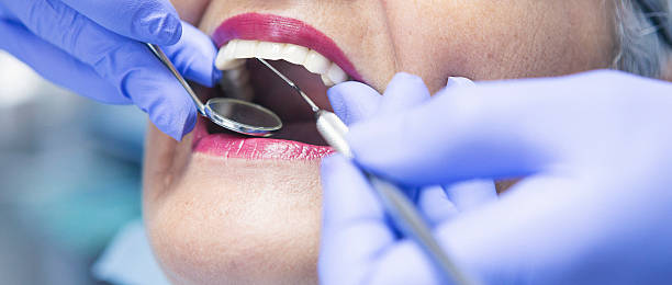 Best Emergency Wisdom Teeth Removal in White Knoll, SC